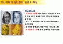 정신지체_ppt 17페이지