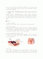 자궁절제수술(hystrectomy) 환자의 수술 전. 후 간호 10페이지
