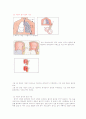기관지천식 case study 2페이지
