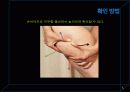 셀룰라이트 5페이지
