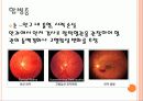 고혈압 6페이지