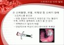 스트레스가 신체에 미치는 영향 및 증상, 원인, 예방, 치료 16페이지