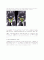 소아 inguinal hernia의 해부학적 구조  2페이지