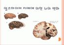 치매와 삶 7페이지