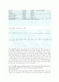 [생리학 실습] 심전도 (electrocradiogram) 11페이지