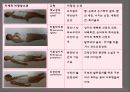 신경계검사 (Neurological examination) 35페이지