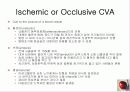 정의,위험요소,유형,자연경과,합병증 6페이지