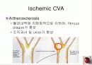 정의,위험요소,유형,자연경과,합병증 11페이지