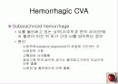 정의,위험요소,유형,자연경과,합병증 25페이지