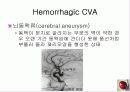 정의,위험요소,유형,자연경과,합병증 26페이지