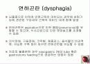 정의,위험요소,유형,자연경과,합병증 34페이지