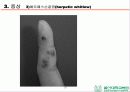 HSV 제출 - Herpes simplex virus 1,2 associated skin disorder 16페이지