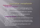 고환암 Testicular cancer 6페이지