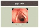 쇼그렌증후군 16페이지