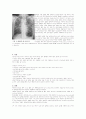 [의약학] 폐결핵 (Pulmonary tuberculosis) 케이스 2페이지