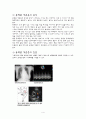 아동 동맥관개존증 case 1 4페이지