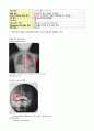 아동Acute Tonsilitis케이스 에이쁠14P 10페이지