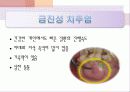 치주학 PPT자료 (3장요약) - 복사본 12페이지