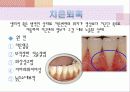 치주학 PPT자료 (3장요약) - 복사본 20페이지