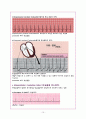 심전도 레포트 (Heart Anatomy & EKG report) 15페이지