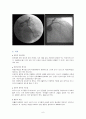 협심증(Angina pectoris) 케이스  6페이지