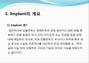 임플란트(Implant)와 관교의치의 개념 및 용어정리.ppt 2페이지