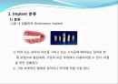 임플란트(Implant)와 관교의치의 개념 및 용어정리.ppt 5페이지