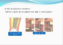 임플란트(Implant)와 관교의치의 개념 및 용어정리.ppt 17페이지