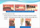 임플란트(Implant)와 관교의치의 개념 및 용어정리.ppt 21페이지