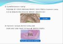 임플란트(Implant)와 관교의치의 개념 및 용어정리.ppt 24페이지