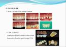 임플란트(Implant)와 관교의치의 개념 및 용어정리.ppt 29페이지