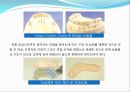 임플란트(Implant)와 관교의치의 개념 및 용어정리.ppt 36페이지