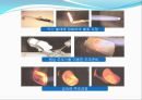 임플란트(Implant)와 관교의치의 개념 및 용어정리.ppt 44페이지