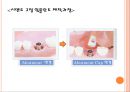 임플란트 제작과정.ppt 15페이지