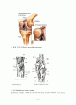 반월상연골제거수술(meniscectomy) 4페이지