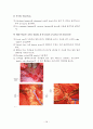 간절제술(liver lobectomy)술기 및 수술간호 18페이지