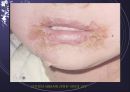 항생제 남용의 문제점과 해결 방안   2페이지