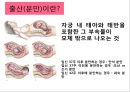 임신과 출산.pptx 11페이지