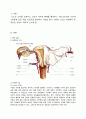 복강경 난소 절제술 (Laparoscopic ovarian cystectomy) 케이스 스터디 3페이지