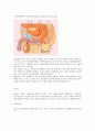 전립선비대증, benign prostatic hypertrophy 1페이지