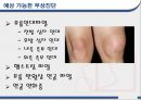 임상생체역학 (십자인대손상,십자인대,부상진단,부상유형,예상 가능한 부상진단).PPT자료 7페이지