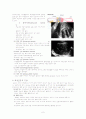 [모성간호학][자궁근종][Myoma] 케이스 스터디(Case Study), 문헌고찰 2페이지