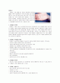 피임법 중 IUD 7페이지