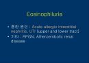요검사의 해석 (urinalysis).ppt 24페이지