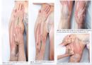 대퇴 사두근 좌상 재활 운동.PPT자료 25페이지