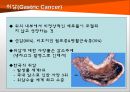 위암 3페이지