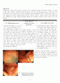 [성인간호학] 크론병 문헌고찰 사례연구 간호과정 Crohn`s disease case study - 문헌고찰, 간호사례 7페이지