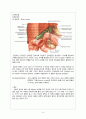 Gallbladder stone Laparoscopic cholecystectomy 담석증 복강경 담낭 절제술 (GB stone gallbladder stone 담석증) case study 4페이지