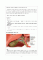 Gallbladder stone Laparoscopic cholecystectomy 담석증 복강경 담낭 절제술 (GB stone gallbladder stone 담석증) case study 6페이지