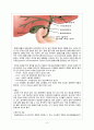 Gallbladder stone Laparoscopic cholecystectomy 담석증 복강경 담낭 절제술 (GB stone gallbladder stone 담석증) case study 9페이지
